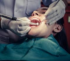 Extraction